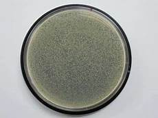Antimicrobial Pvc Windows