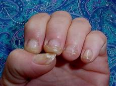 Acrylic Hardeners