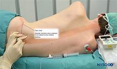 Anesthetics