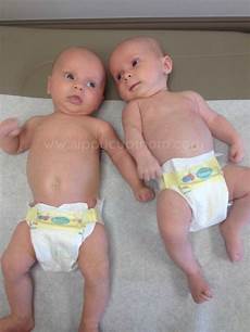 Baby's Nappies