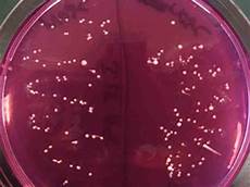 Bacteria
