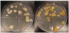 Bacteria