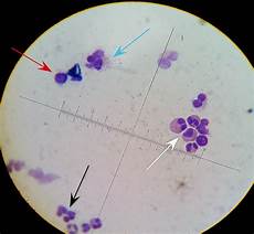 Cidofovir