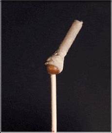 Concial Joints