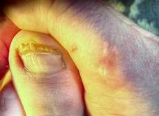Cuticle Oil