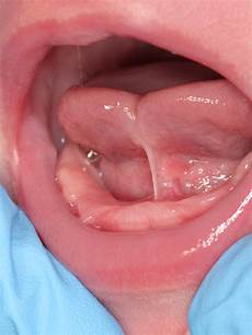 Dental Care