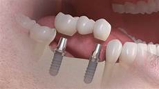 Dental Equipment & Supplies
