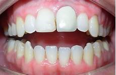 Dental Kit