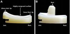 Femoral Component