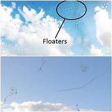 Floater