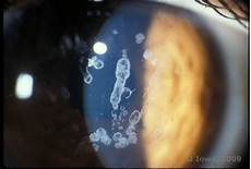 Granular