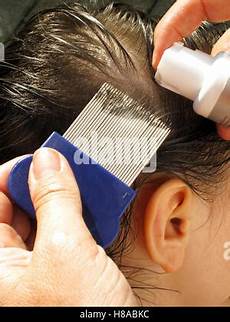 Headlouse Spray