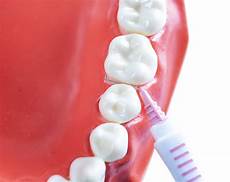 Interdental Brush