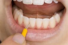 Interdental Brush