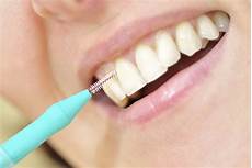 Interdental Brush