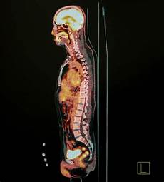 Interventional Materials
