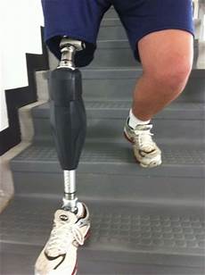 Knee Prosthesis