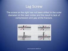 Lag Screw