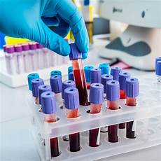 Medical Consumables