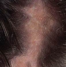 Medical Creams