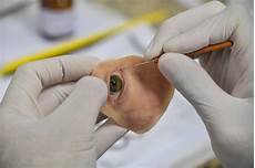 Medical Prosthesis