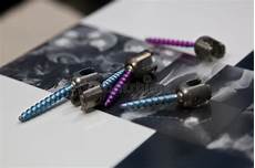 Medical Screws