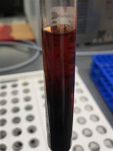 Medical Serum