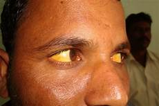 Medical Serum