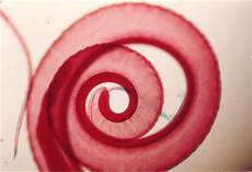 Microbial