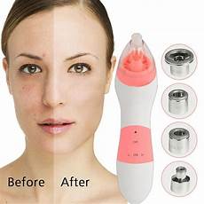 Microdermabrasion Machine