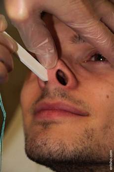 Nasal Drop