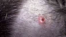 Nipples