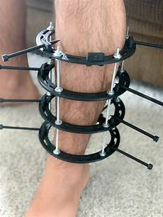 Orthopedic Products