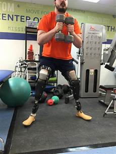 Orthopedic Prosthesis