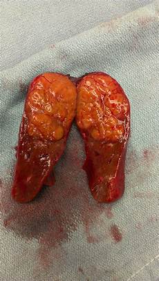 Other Body Parts