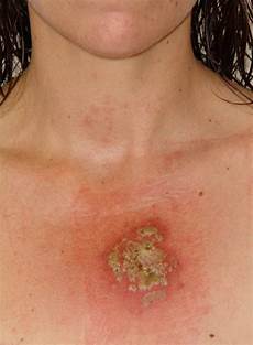 Other Breast Care Products