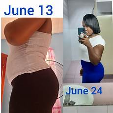 Other Weight Loss Products