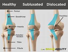 Patella