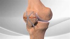 Patella