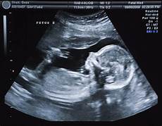 Pregnancy Tests