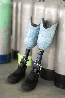 Prostheses