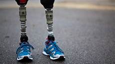 Prostheses