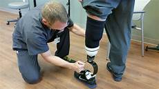 Prostheses