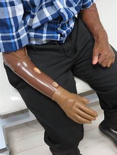 Prostheses