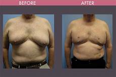 Reconstructive Creams