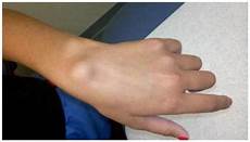 Round Elbow