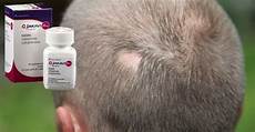 Ruxolitinib