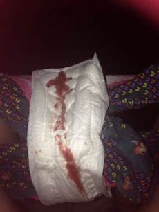 Sanitary Pad
