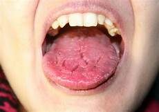 Sealants