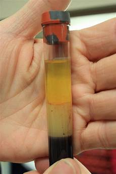 Serum